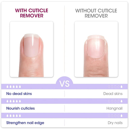 QAZIXU 10ml Nail Care Cuticle Remover Nail Polish for Dead Skin Gel Manicure Treatment Tool For Nail Art DIY Salon Home