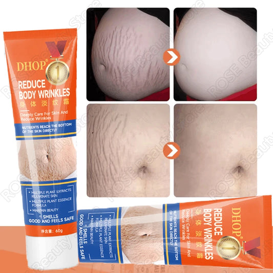 Stretch Marks Permanent Removal Cream Maternity Pregnant Women Pregnancy Anti-Winkle Smooth Repair Firming Skin Body Skin Care