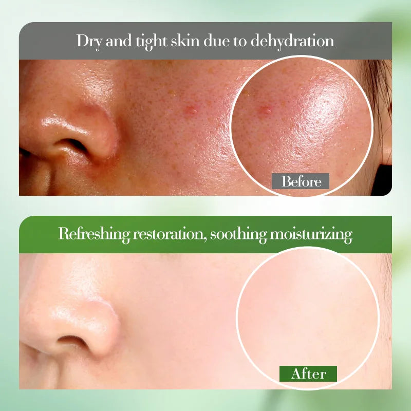 Aloe Vera Gel 100% Natural For Face And Body, Hydrating Moisturizing Soothing Skin For Sunburn Relief, Acne, After Sun Care 50g