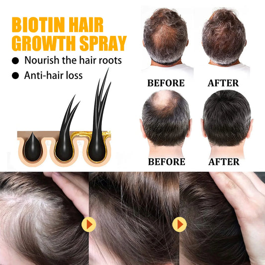Biotin Hair Care Spray Nourish Scalp Hair Follicle Reduce Hair Loss Stabiliz Hair Root Refresh Oil Control Natural Plant Essence