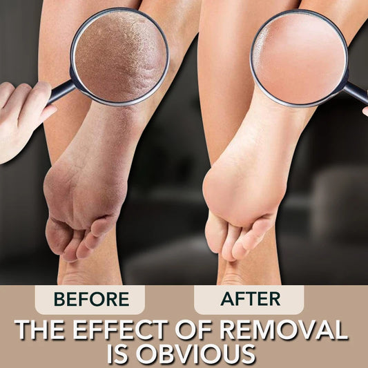 1pcs Nano Glass Double-sided Foot Rasp Heel File Hard Dead Skin Callus Remover Exfoliating Pedicure Care Foot File Tool