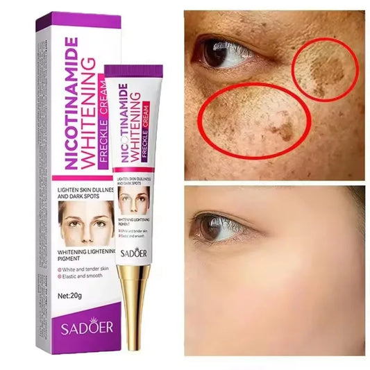 SADOER Freckle Removing Cream Nicotinamide Face Cream for Faical Moisturizing Nourishing Hydrating Firming Spot Facial Creams