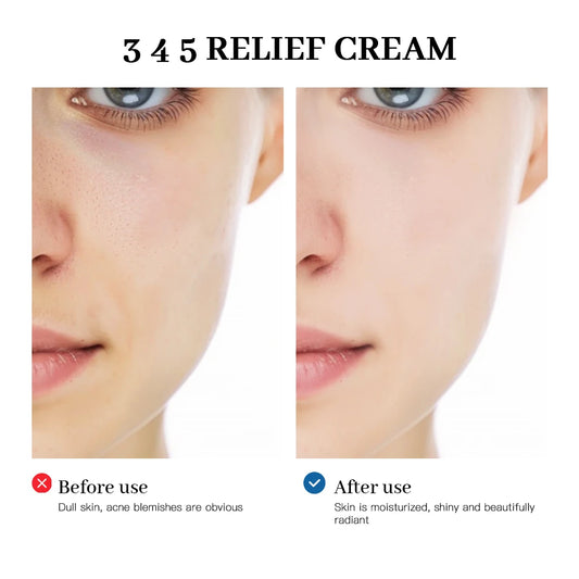 345 Relief Cream Comprehensive solution to skin problems Anti-sugar and antioxidant Brightening skin Improving acne marks Moistu
