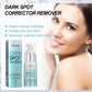 Freckle Whitening Cream Fade Dark Spot Blemish Acne Mark Remove Melanin Shrink Pores Lightening Pigmentation Correction Cream