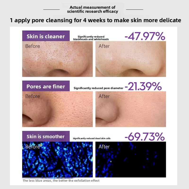 OHBT Perilla Fruit Acid Clay Mask Deep Cleansing Mud Mask Oil Control Mask Deep Moisturizing Fast Absorption 150g