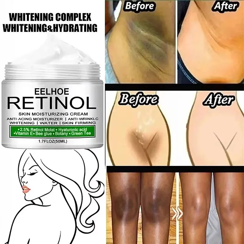 Body Whitening Cream Dark Skin Armpit Lightening Intimate Areas Underarm Bleaching Private Parts Whiten Cream Body Lotion Beauty