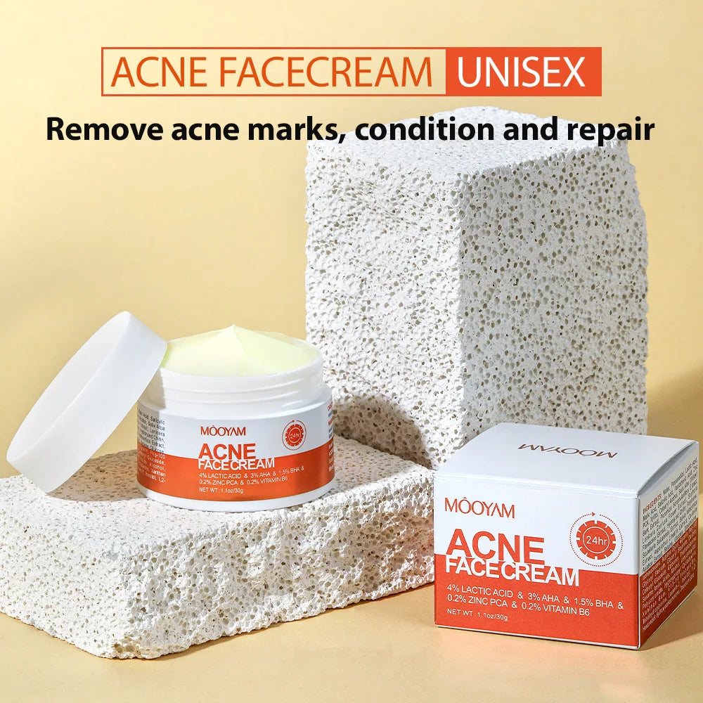 Herbal Acne Removal Face Cream Anti-Acne Gel Treatment Acne Scar Pore Shrinking Eliminate Large Pores Pimples Whitening Face Car