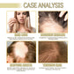 EELHOE Rosemary Oil Hair Growth Products Anti Hair Loss Treatment Volume Hair Thickener Strengthening Rosemary Essential Oil
