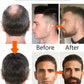 The most effective beard growth essence in 2025, grow a thick beard in 7 days. Chest hair, leg hair, beard and hair growth