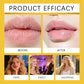 HOYGI Lip Balm Bee Venom Lipstick Soothing Repair Anti Dry Cracked Hyaluronic Acid Hydrating Nourishing Moisturizing Lip Care