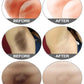 Whitening Cream For Dark Skin Underarm Bleaching Armpit Lightening And Intimate Area Woman Moisturizer Korean Skin Care Products