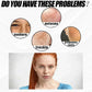 Whitening Freckle Cream Effectively reduces dark spots Brightens and revitalizes dull skin  Hydrates and nourishes the skin
