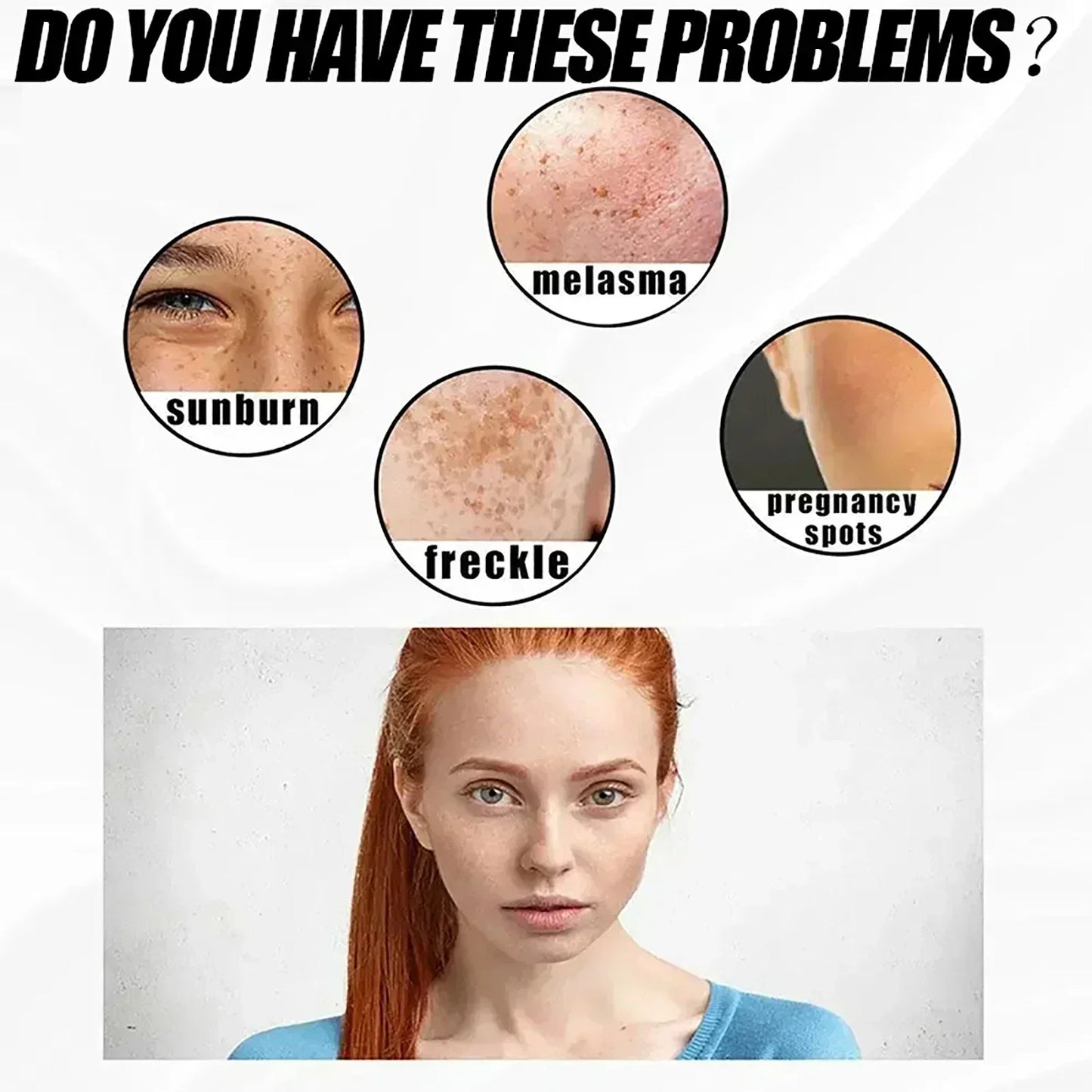 Whitening Freckle Cream Effectively reduces dark spots Brightens and revitalizes dull skin  Hydrates and nourishes the skin