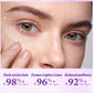 Instant Eye Bag Removal Cream Retinol Anti-Wrinkle Firming Skin Fade Fine Lines Anti Dark Circle Puffiness Brighten Eye skinCare