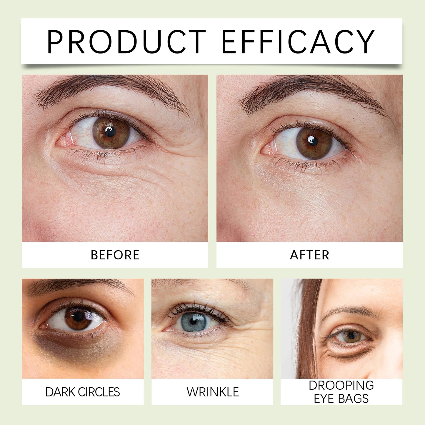 HOYGI Collagen Eye Serum Anti Puffiness Eye Bags Anti Dark Circles Moisturizing Tightening Reduce Fine Lines Skin Care Roller