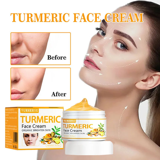 Anti Acne Turmeric Cream, Fades Scars & Dark Spots, for Oily and Dull Skin, Brightening Turmeric Face Care Treatment, 50ml