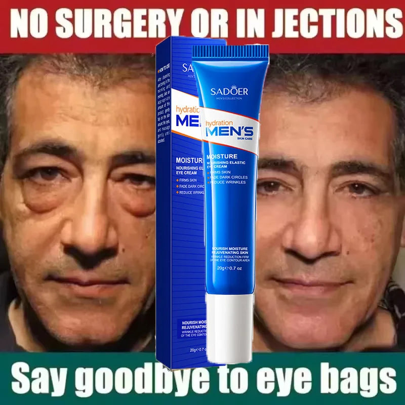 Retinol Eye Bag Removal Cream For Men Anti-Wrinkle Firming Skin Fades Fine Lines Anti Dark Circle Puffiness Brightening Eye Care