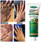 Fast Whitening Hand Cream Dark Knuckles Brighten Moisturizing Intense Stains Remover Melanin Corrector Products hand Skin Care