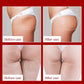 Buttock Lifting Cream Hip Breast Plump Growth Massage Prevent Sagging Boobs Bigger Tightening Shaping Butt Enlargement Cream