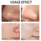 A variety of clay masks, green tea, turmeric, Dead Sea mud, whitening and hydrating, deep cleansing of pores, oil control and mo