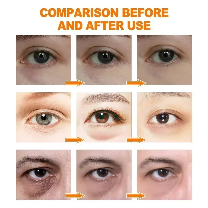 Anti Dark Circle Eye Serum Oil Retinol Anti Wrinkle Firming Skin Remove Eye Bag Fade Fine Line Whitening Brighten Eye Care Korea