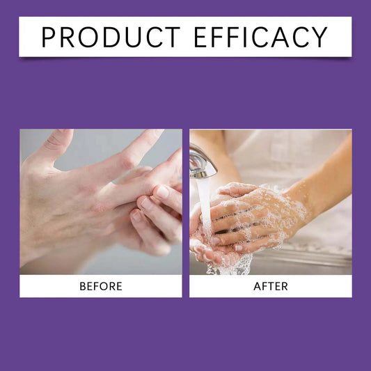 Grape Bunch Shaped Soap Bar Natural & Mild Cleansing Bar for Face and Body Gentle for Sensitive Skin Moisturizing Handmade