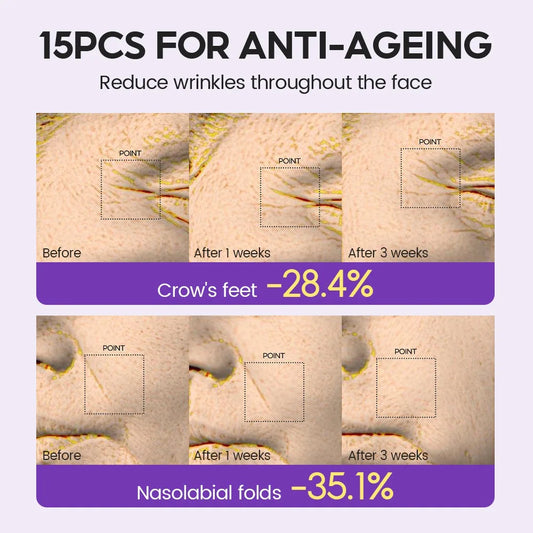 Retinol + Pro-xylane Ampoule serum  Repairs Strengthens The Skin And Diminishes Fine Lines Face Beauty Skin Care 15pcs