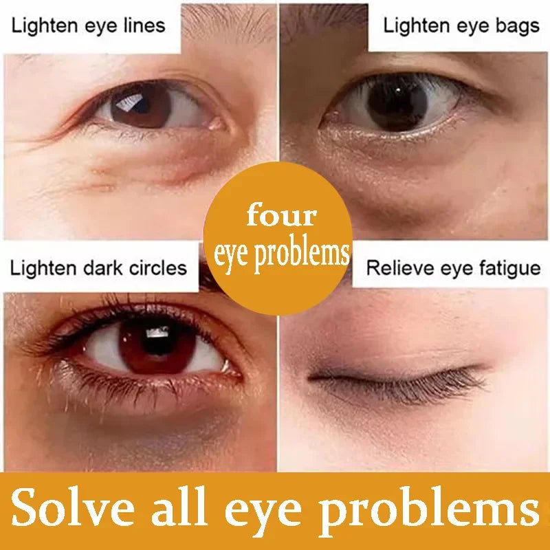 Anti Dark Circle Eye Serum Oil Retinol Anti Wrinkle Firming Skin Remove Eye Bag Fade Fine Line Whitening Brighten Eye Care Korea