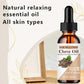 Clove essential oilimproves skin elasticity shine facial care Moisturizing Repair Anti-aging  helps keep skin hydrated