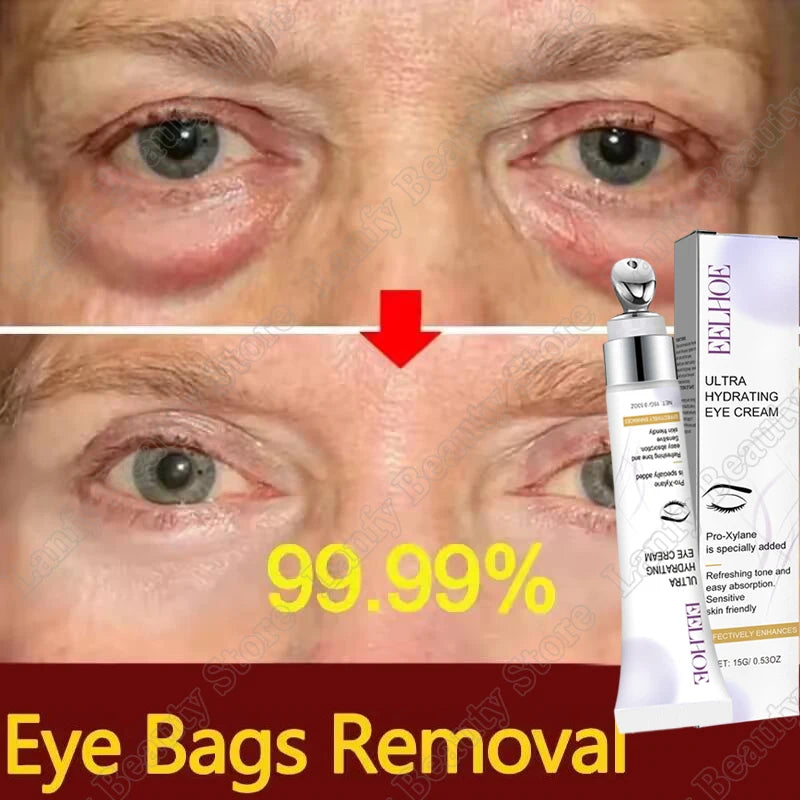 Instant Eye Bag Removal Cream Collagen Anti-Wrinkle Fade Fine Lines Firming Skin Anti Dark Circle Puffiness Brighten Eye Care