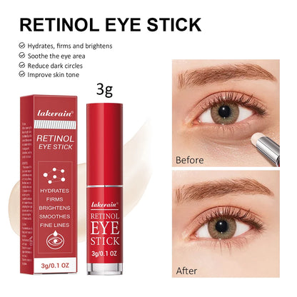 Anti-Wrinkle Eye Cream Stick Retinol Remove Eye Bags Dark Circles Anti Aging Lifting Whitening Moisturizing Brighten Eye Primer