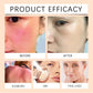 EELHOE Vitamin E Sunscreen Spray 100ml Long-lasting Deep Moisturizing Anti-UV Skin Protector Anti Oxidant Face Body Skin Care