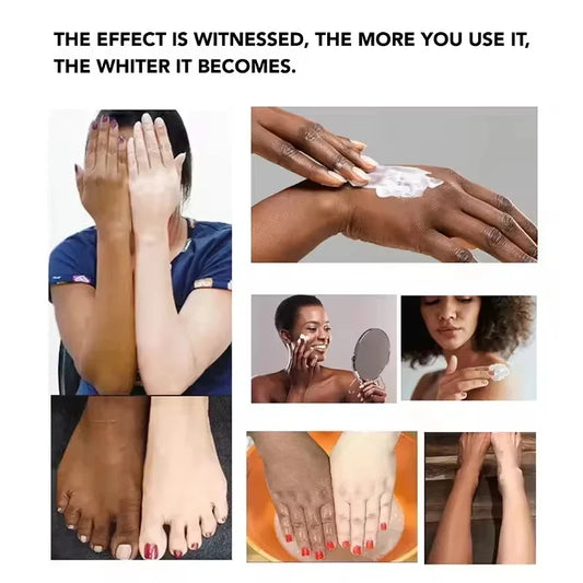 Body Whitening Bleach Cream Brighten Underarm Elbow Knees Joint Removal Intimate Parts Dark Spots Melanin Snow Bleach Cream