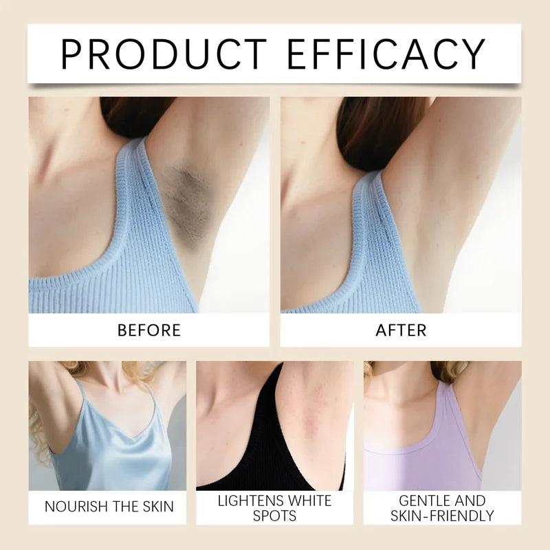 YUITIKUE Underarm Brightening Cream 150g - 2-in-1 Evens & Whitens, Vitamin C Formula, Dark Spot Corrector, Smooth Skin Care