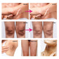 Body Whitening Cream Private Parts Underarm Dark Skin Bleaching Serum Niacinamide Whitening Lighten Dark Spots Snow Bleach Cream
