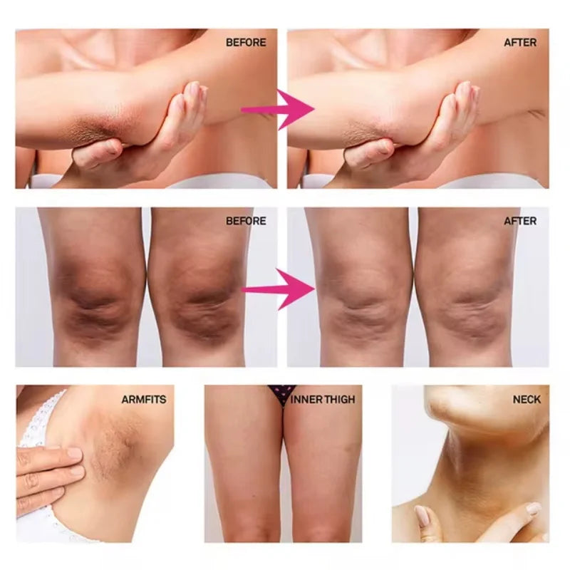 Body Whitening Cream Private Parts Underarm Dark Skin Bleaching Serum Niacinamide Whitening Lighten Dark Spots Snow Bleach Cream