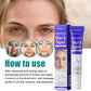 Dark Spots Removal Cream Facial Whitening Freckle Acne Mark Pigmentation Removal Melanin Skin Correction Brighten Care Products