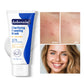 Acne Foaming Wash Deep Cleaning Unclogs Pores Prevents Breakouts for Face & Body Moisturizers Reduces Redness Skin Care