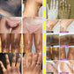 Niacinamide Whitening Cream Stick Remove Dark Spots Bleaching Private Parts Underarm  Brighten Butt Knee Inner Thigh Body Care