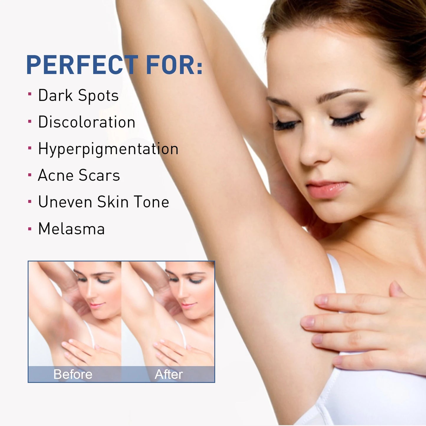 Whitening Cream To Private Area Armpits Bikini Zone Reduce Dark Spots Improve Luster Brighten Skin Moisturizing Body Care Lotion
