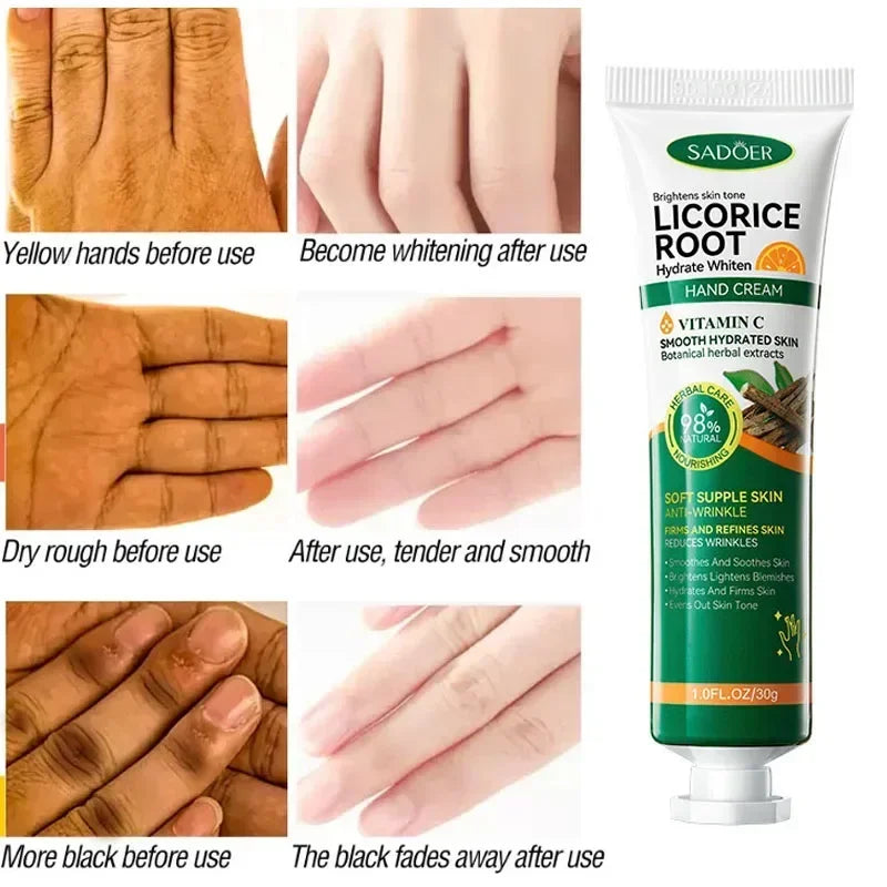 Fast Whitening Hand Cream Dark Knuckles Brighten Moisturizing Intense Stains Remover Melanin Corrector Products hand Skin Care