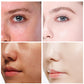 Hllozzi 34g*4 Bio-Collagen Sheet Mask w/Hyaluronic Acid & Vitamin C Hyaluronic Acid Hydrating Sleeping Mask