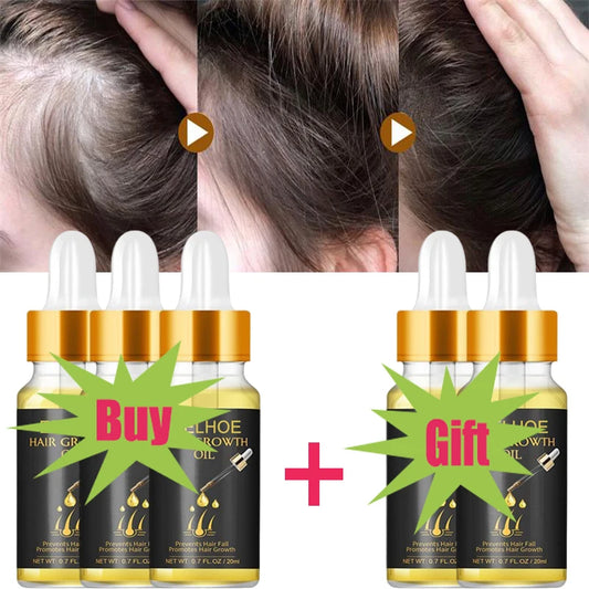 Fast Hair Growth Serum Hair Regrowth Essential Oil Anti Hair loss Repair Damaged Scalp Women Men Anti Baldness Hair Growth Care