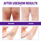 Body Whitening Cream Brightening Intimate Area Underarm Butt Inner Thigh Bleaching Remove Melanin Private Parts Whitening Cream
