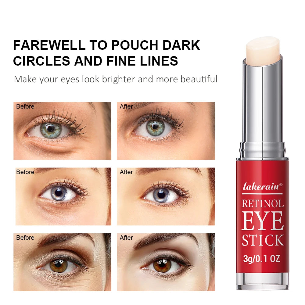 Anti-Wrinkle Eye Cream Stick Retinol Remove Eye Bags Dark Circles Anti Aging Lifting Whitening Moisturizing Brighten Eye Primer