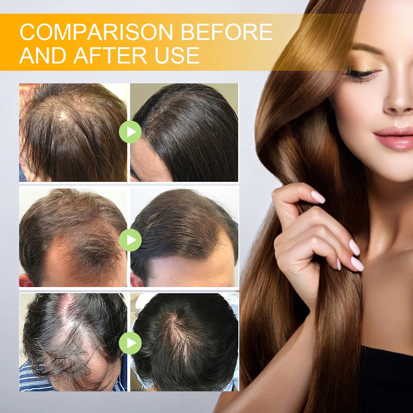 Biotin Hair Care Spray Nourish Scalp Hair Follicle Reduce Hair Loss Stabiliz Hair Root Refresh Oil Control Natural Plant Essence