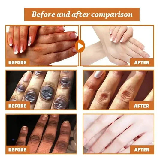 Fast Whitening Hand Cream Dark Knuckles Brighten Moisturizing Intense Stains Remover Melanin Corrector Products hand Skin Care