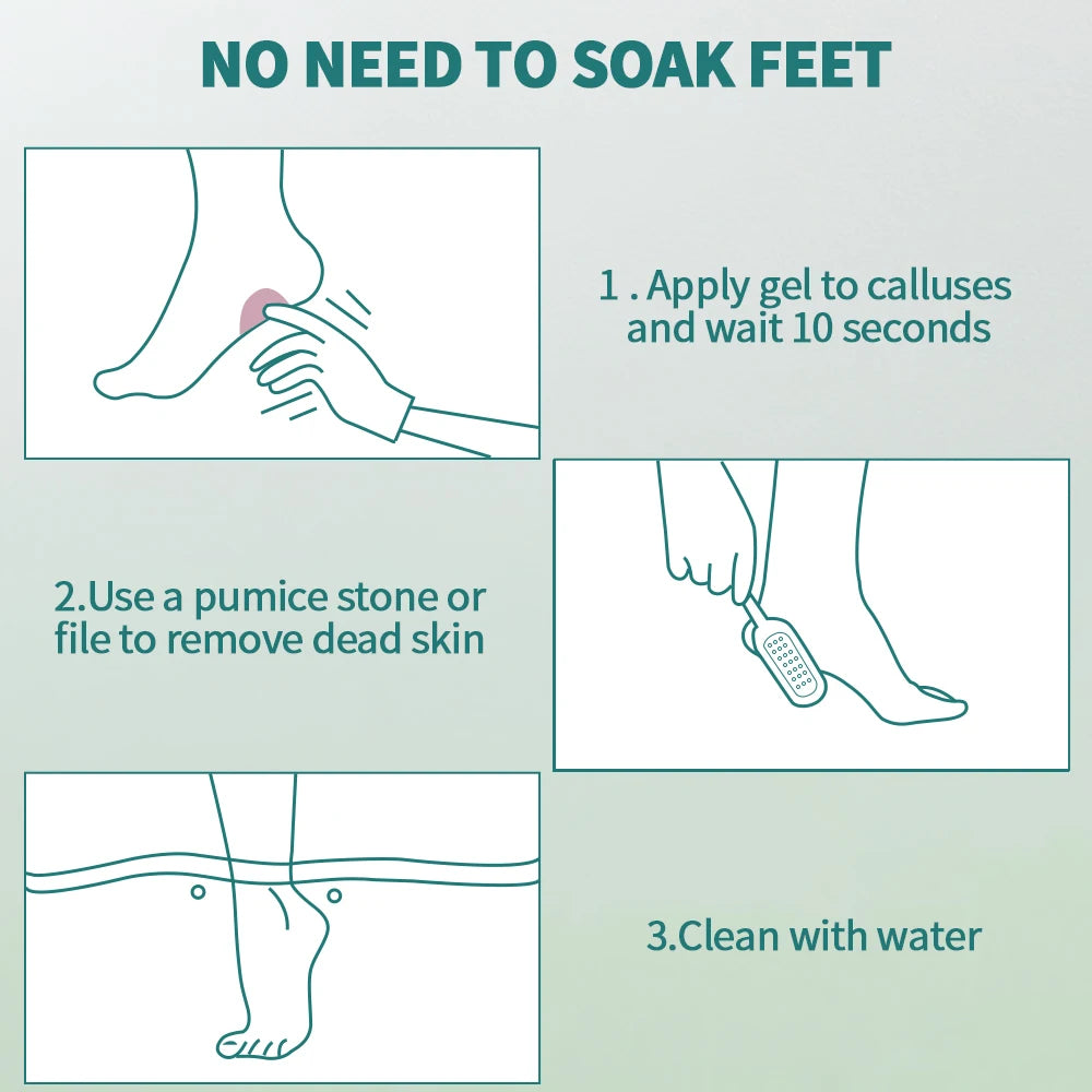 NAILPOP Extra Strength Callus Remover for Feet and Foot File Kit Remove Hard Skins Heels and Tough Callouses from feet Quickly