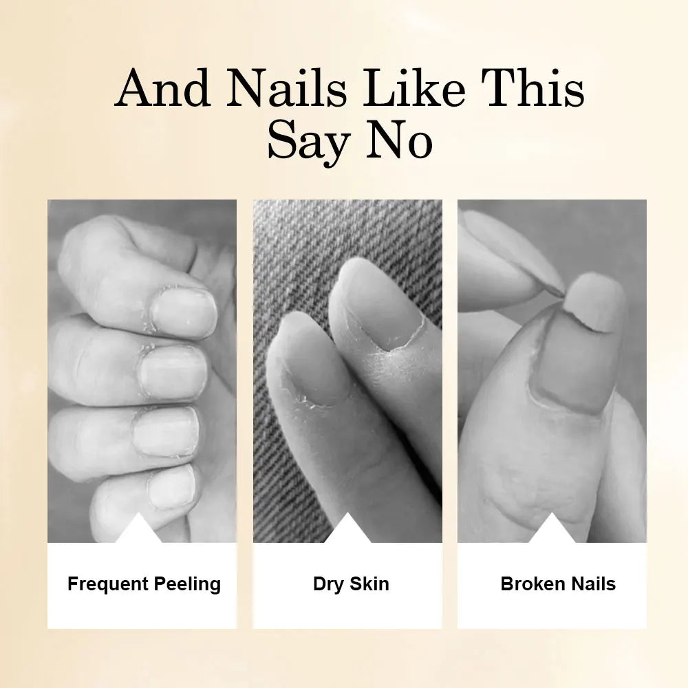 LIMEGIRL15ML Nail Cuticle Nutrient Oil Nourishes and Repairs Damaged Nails Moisturizing Strengthens and Brightens Nail Care
