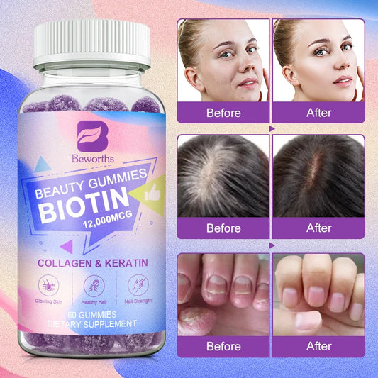 Vitamin Biotin Gummies 12,000 mcg for Stronger Hair, Skin & Nails - 60 Gummies